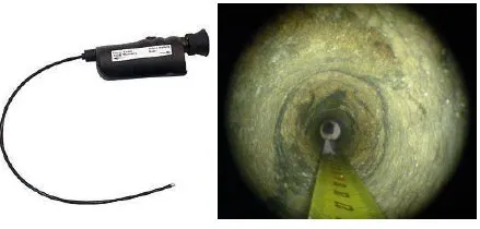 Endoscopia